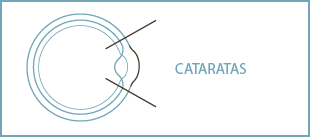 img-sin-color-cataratas